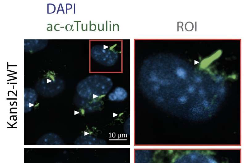Unlocking the secrets of cell antennas